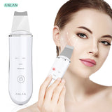 Ultrasonic Skin Scrubber Deep Face Cleaning Machine